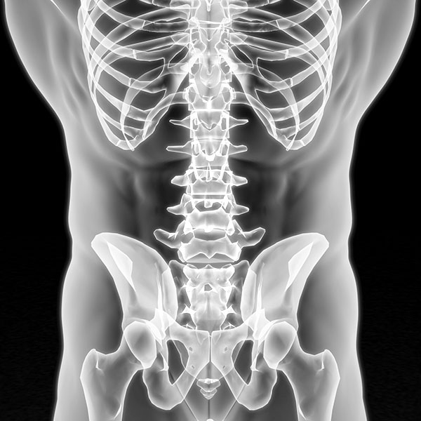 Digital Motion X-ray